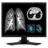 NEC Displays 21" Color 3-Megapixel Medical Diagnostic Monitor